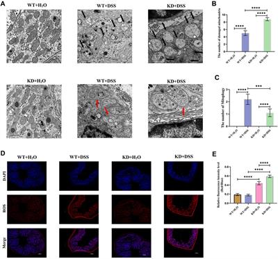 Heat Shock Transcription Factor 2 Promotes Mitophagy of Intestinal Epithelial Cells Through PARL/PINK1/Parkin Pathway in Ulcerative Colitis